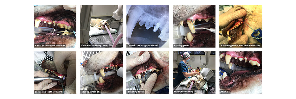 the dental process
