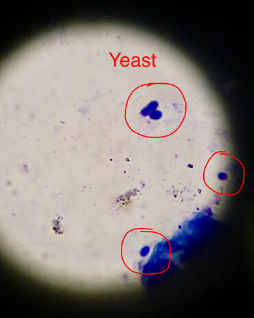 yeast under the microscope